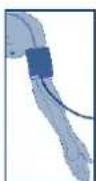 UEBE Visomat double comfort - Applicazione del bracciale - 3