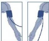 UEBE Visomat comfort form - Attaching the cuff - 3