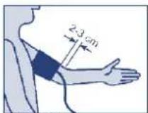 UEBE Visomat comfort form - Attaching the cuff - 2