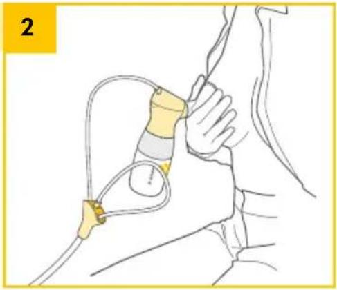 MEDELA Sonata - 11B. Extracción simple - 2