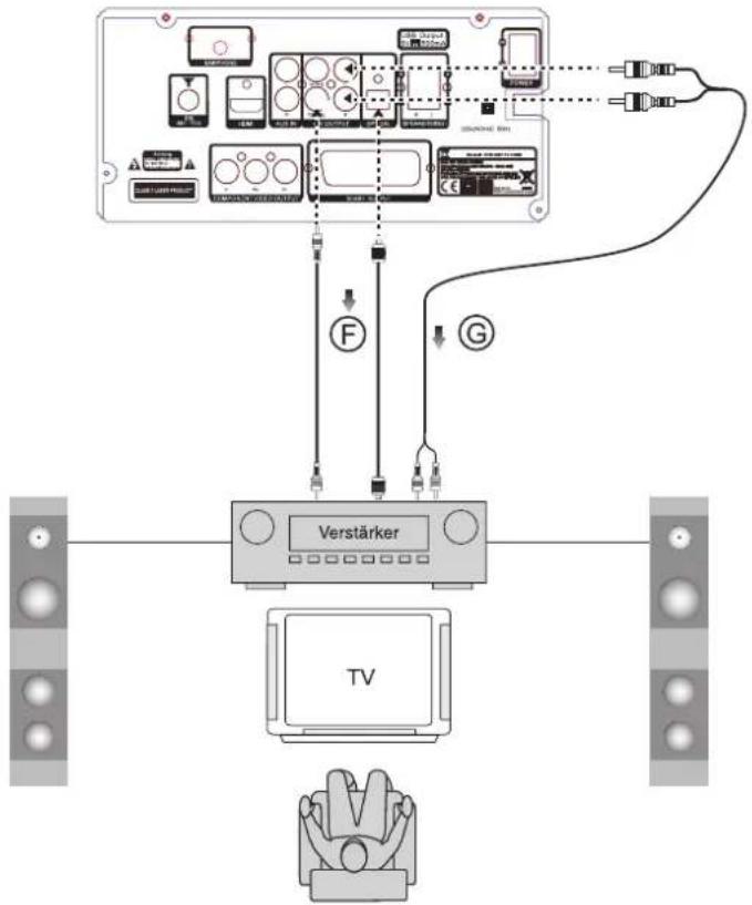 DUAL DVD-MS 111 BT - Remarque : - 1
