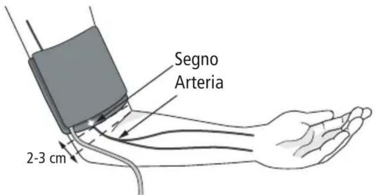 BOSO Varius - Fissaggio del bracciale - 1