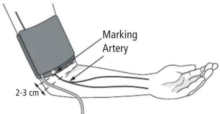 BOSO Varius - Attaching the cuff - 1