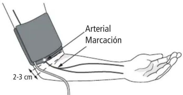 BOSO Varius - Poner el manguito - 1