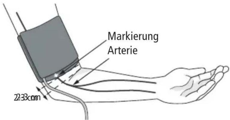 BOSO Varius - Anlegen der Manschette - 1