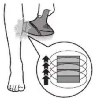PHILIPS Lumea BRI946 - Zwei Behandlungsmodi: "Halten + Lichtimpuls und "Gleiten + Lichtimpuls" - 2