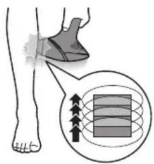 PHILIPS Lumea BRI946 - C Behandeling - 6