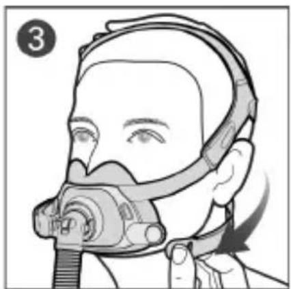 ResMed AirFit F40 - Consumer Warranty - 40