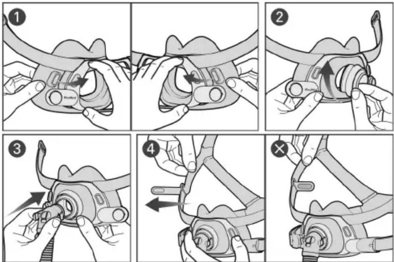 ResMed AirFit F40 - Reassembling your mask - 1