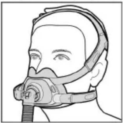 ResMed AirFit F40 - Consumer Warranty - 5