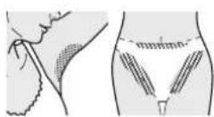 PANASONIC ES-ED64 - Areas suitable for epilation - 4