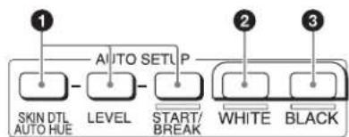 SONY MSU-1000 - Bloc AUTO SETUP - 1