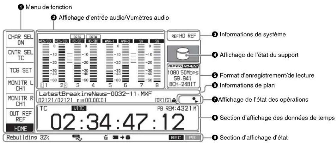 SONY XDS-PD2000 - Ecran des opérations de base - 2