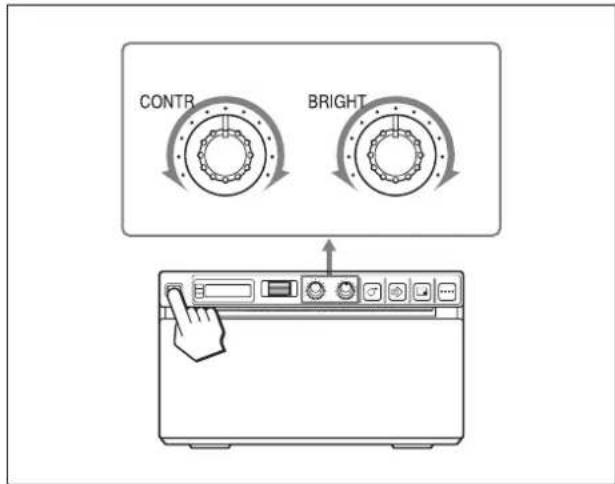 SONY UP-897MD - 명망 및 밝기 조정 - 1