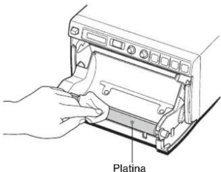 SONY UP-897MD - Limpieza de la platina - 2