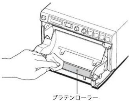 SONY UP-897MD - プラテンローラーのクリーニング - 2