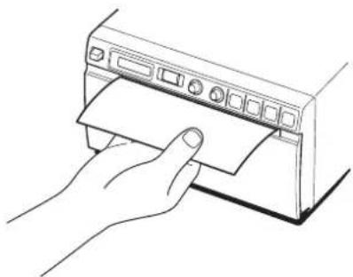 SONY UP-897MD - Cleaning the Platen Roller - 1