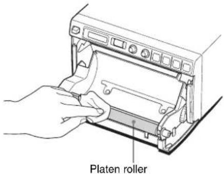 SONY UP-897MD - Cleaning the Platen Roller - 2