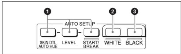 SONY RCP-1500 - Bloc AUTO SETUP - 1