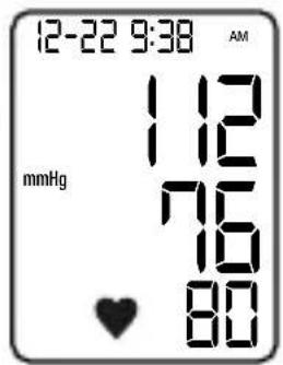 LANAFORM Blood Pressure Monitor - ЗАКРЕПВАНЕ НА НАДУВАЩИЯ СЕ МАНШЕТ - 4
