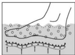 LANAFORM Bubble Footcare - 5