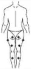 LANAFORM Medi Stim - Mode EMS - 1