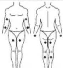 LANAFORM Medi Stim - MODE TENS - 2