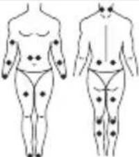 LANAFORM Medi Stim - Mode TENS - 5