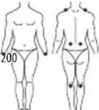 LANAFORM Medi Stim - Mode TENS - 4