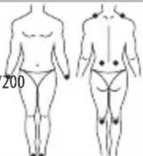 LANAFORM Medi Stim - MODE TENS - 4
