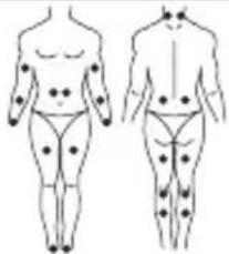 LANAFORM Medi Stim - MODE TENS - 5
