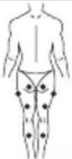 LANAFORM Medi Stim - EMS-modus - 1