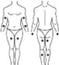LANAFORM Medi Stim - Mode TENS - 2