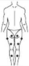 LANAFORM Medi Stim - EMS mode - 1