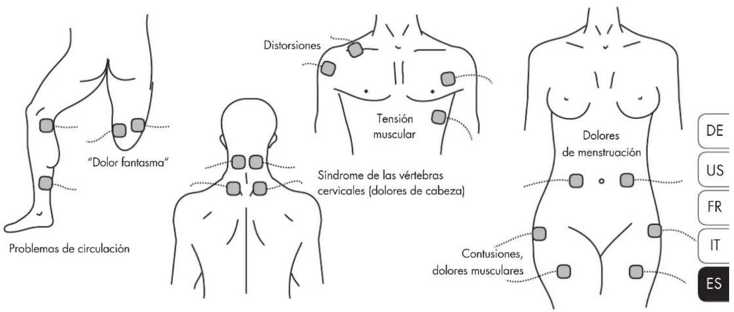 Promed Tens 1000 s - COLOCACIÓN DE LOS ELECTRODOS - 1