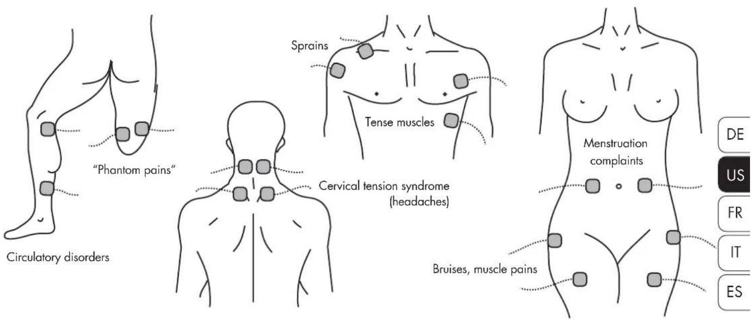 Promed Tens 1000 s - POSITIONING ELECTRODES - 1