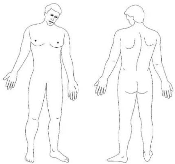 Promed Tens 1000 s - Clinical recommendations for setting up the tens 1000 s - 1