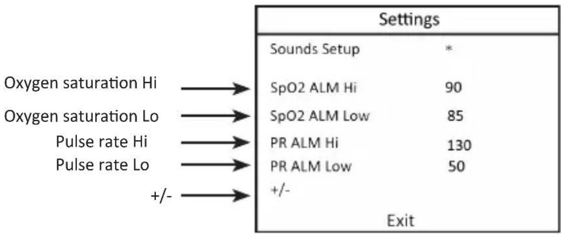 Medicinalis 303894 - Parameter settings (ALM Settings) - 1