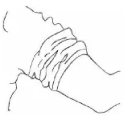 Medicinalis 303936 - Come applicare il bracciale alla parte superiore del braccio - 1