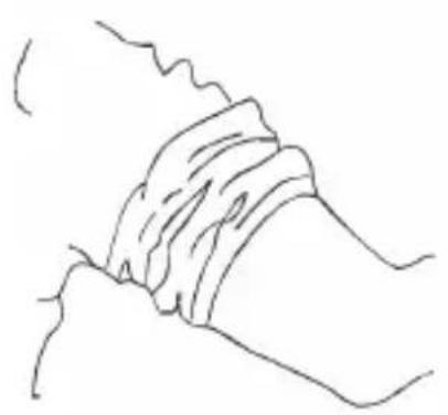 Medicinalis 303936 - Placing the cuff on the upper arm - 1