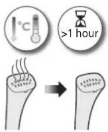 PHILIPS STE1040 - Membersihkan dan menyimpan penstim dirian - 2