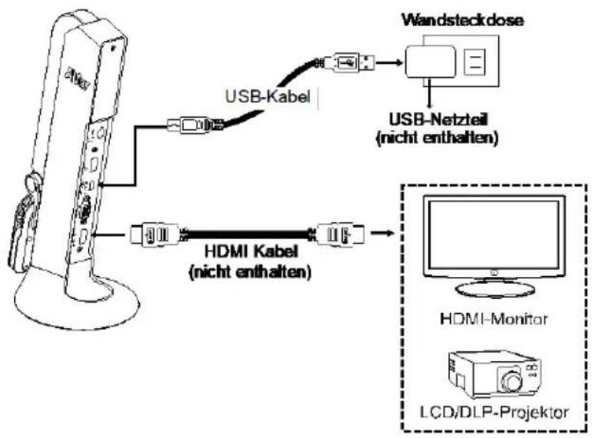 AVer AVerVision M11-8MV - HDMI-Verbindung - 1