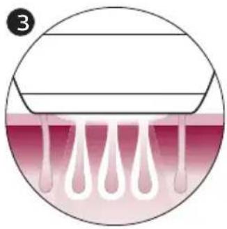 PHILIPS Lumea 9000 Series BRI958 - How IPL works - 3