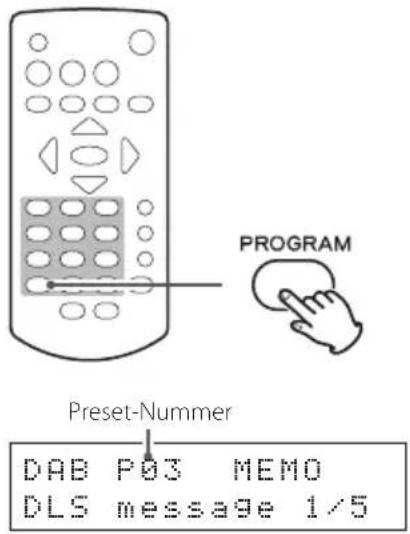 TEAC PD-301DAB-X - ANMERKUNG - 2