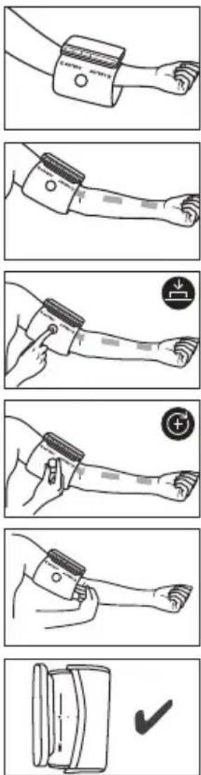 BEURER BM 81 easyLock - Applicazione del manicotto - 1