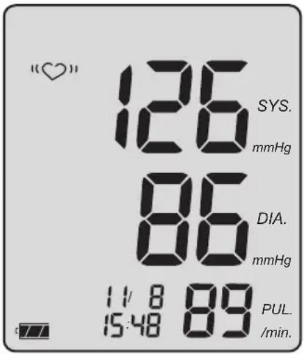 BOSO Medicus Prestige S - Visualizzazione dei valori pressori - 1