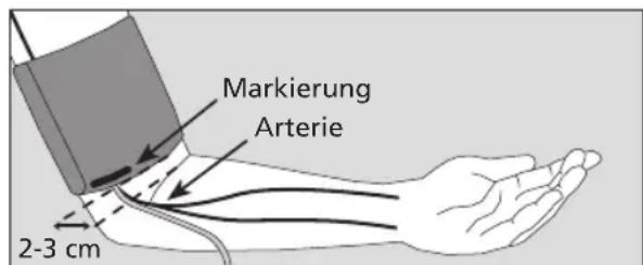 BOSO Medicus System - Vorbereitung zur Blutdruckmessung - 1