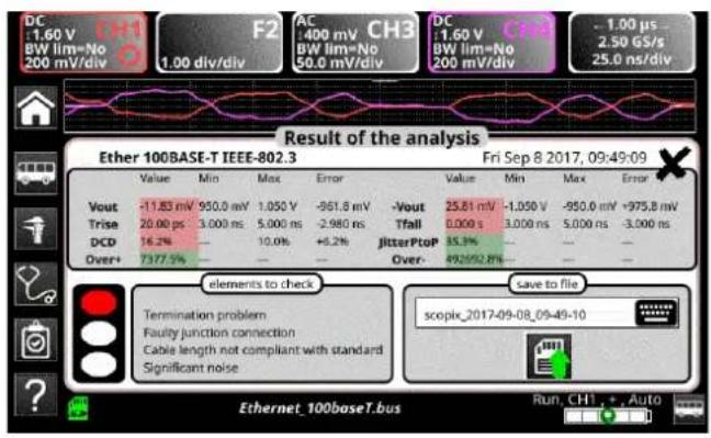 METRIX ScopiX IV OX9062 - Mise en œuvre - 3