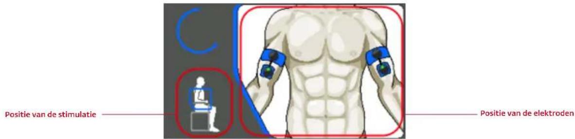 COMPEX Wireless - POSITIE VAN DE ELEKTRODEN - 1
