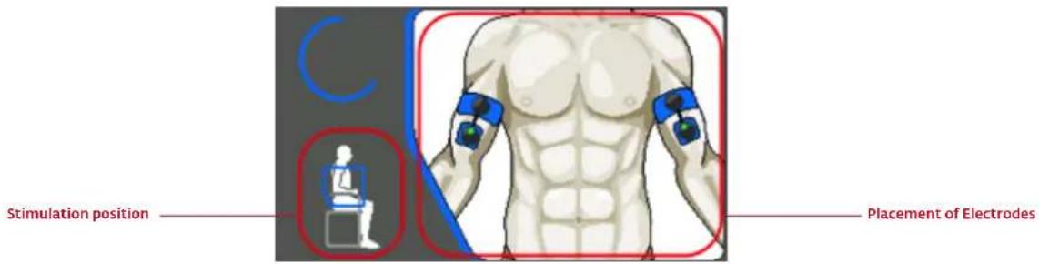 COMPEX Wireless - ELECTRODE PLACEMENT - 1